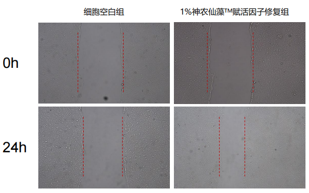 细胞划痕实验图.png